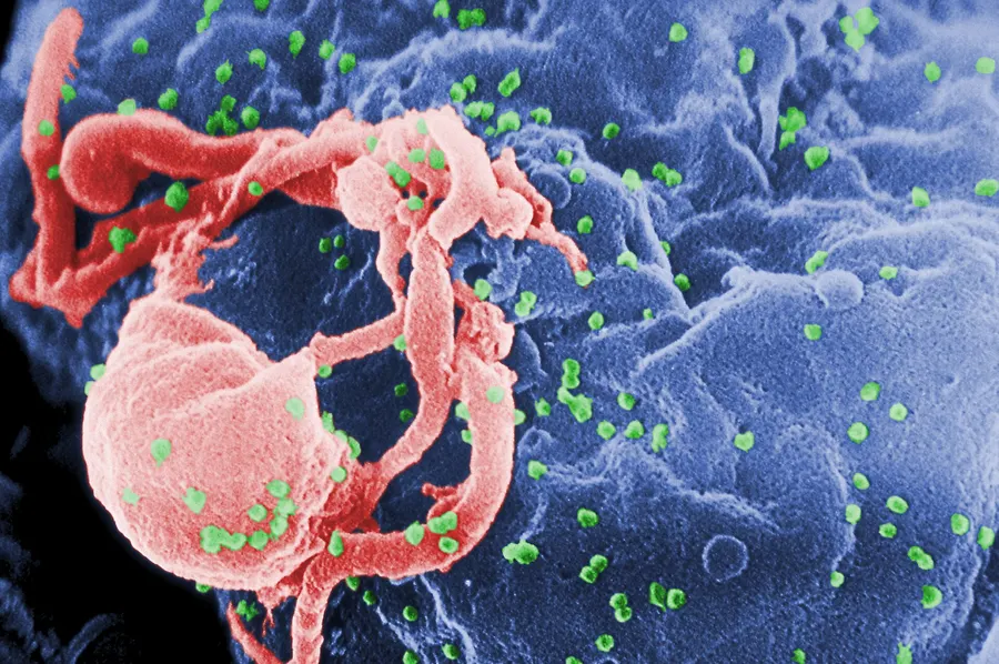 HIV particles budding from a cell, in a coloured electron micrograph from the US Centers for Disease Control
