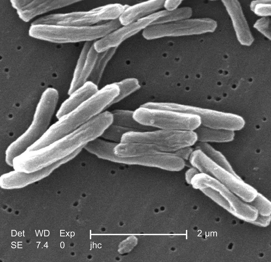 Tuberculosis bacteria under a scanning electron microscope.